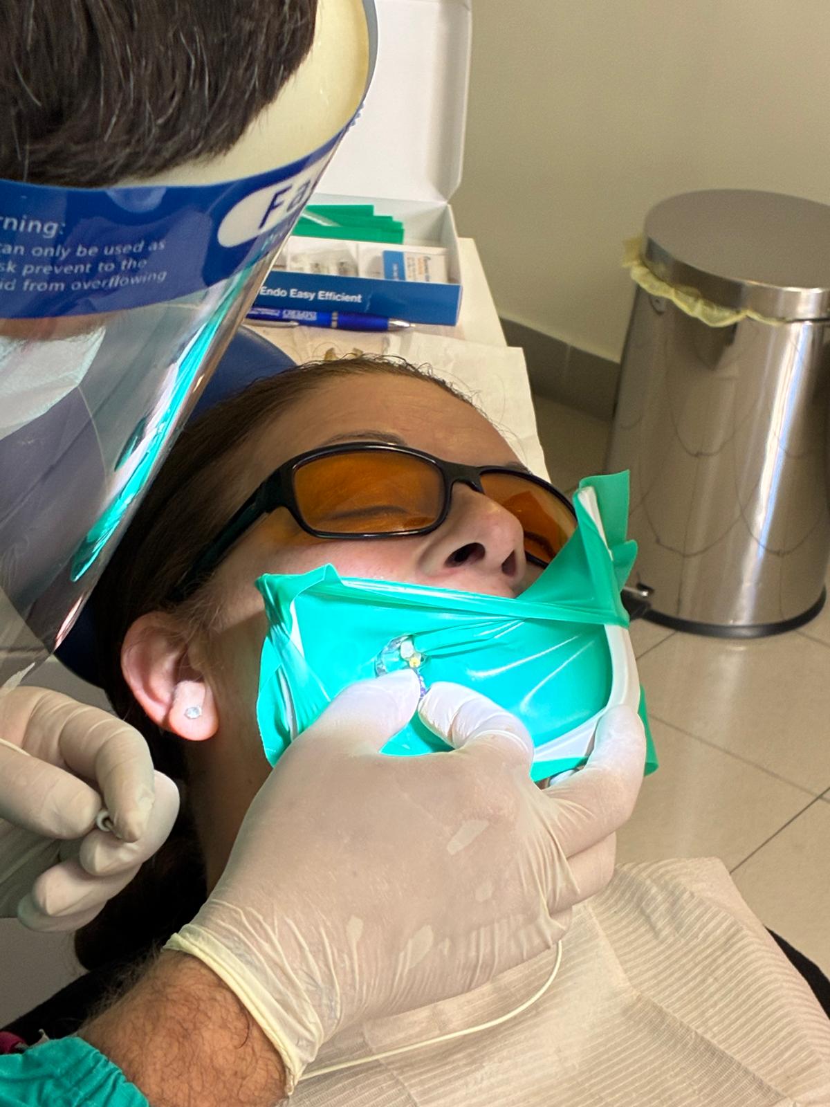 Trattamento endodontico — devitalizzazione