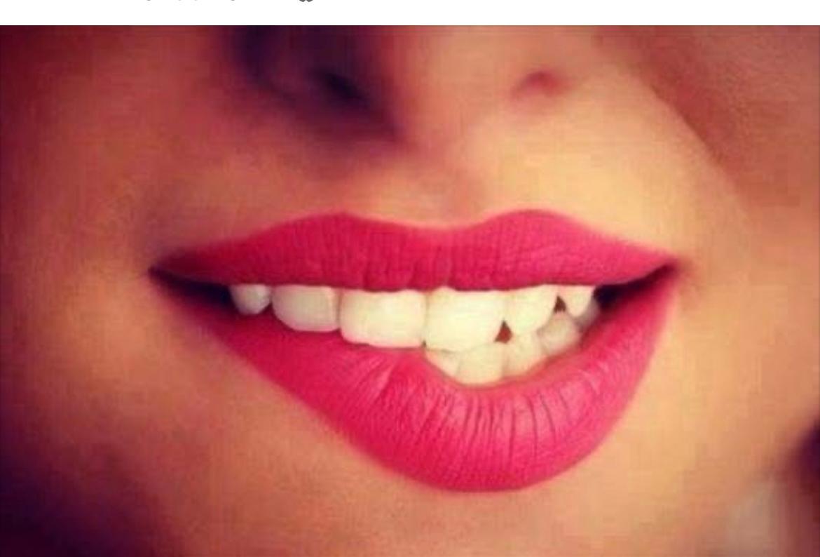 Sbiancamento dentale professionale